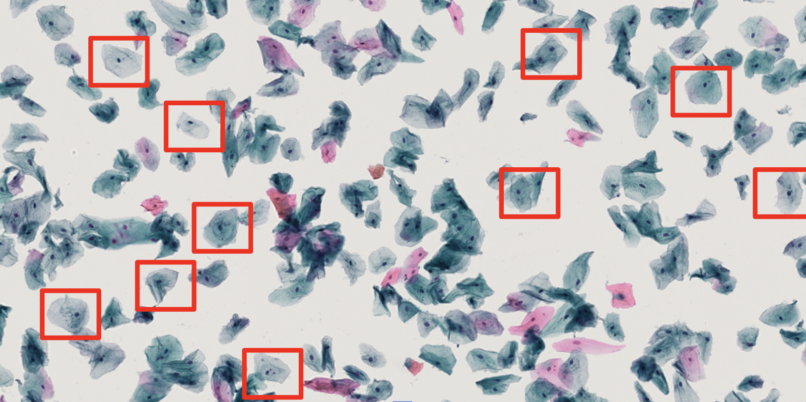 Detected cells in a cytology whole-slide image patch