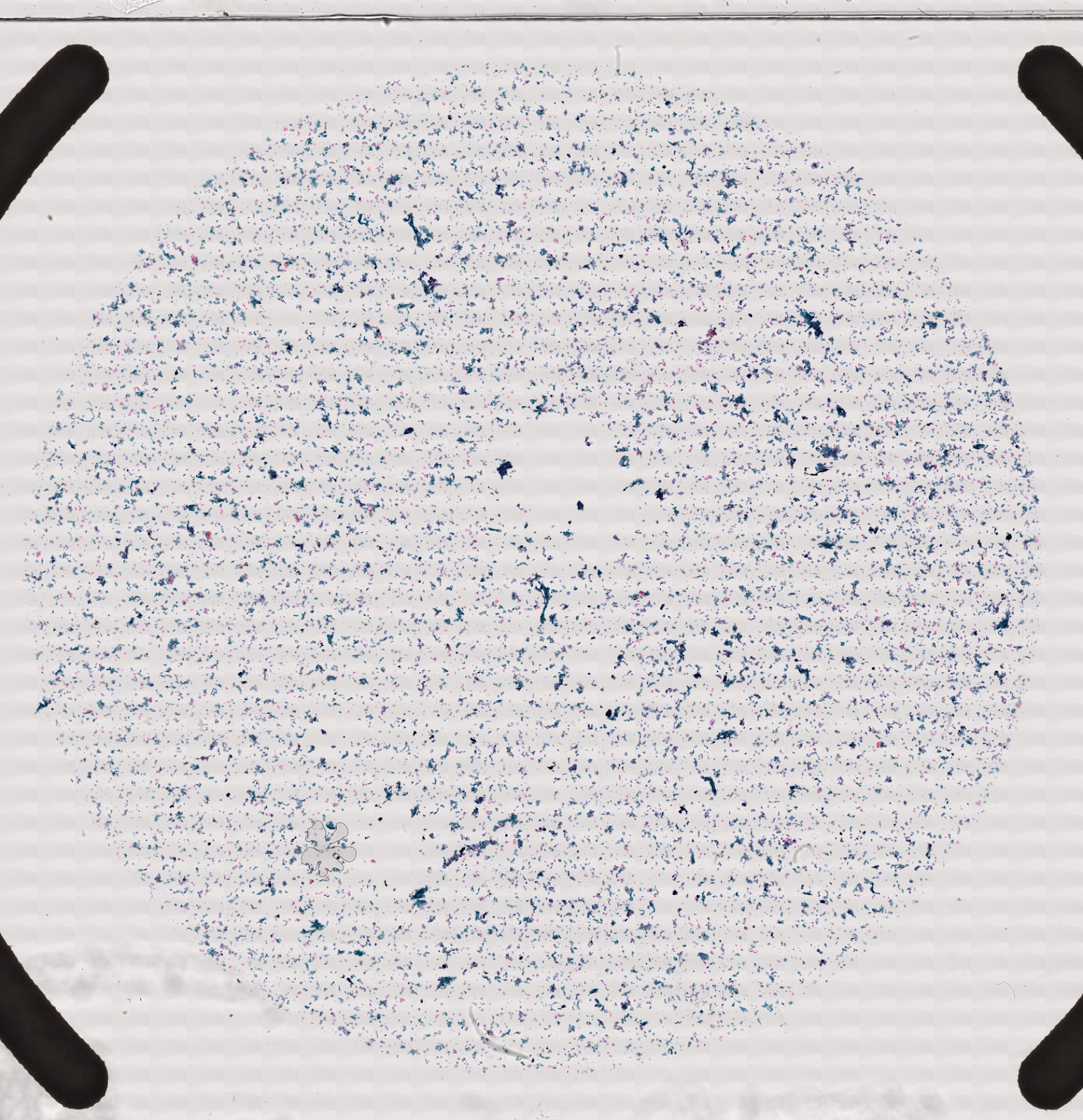 Whole-slide cytology image with many cells