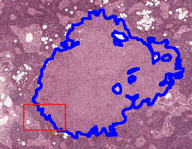 Histology patch with tissue context