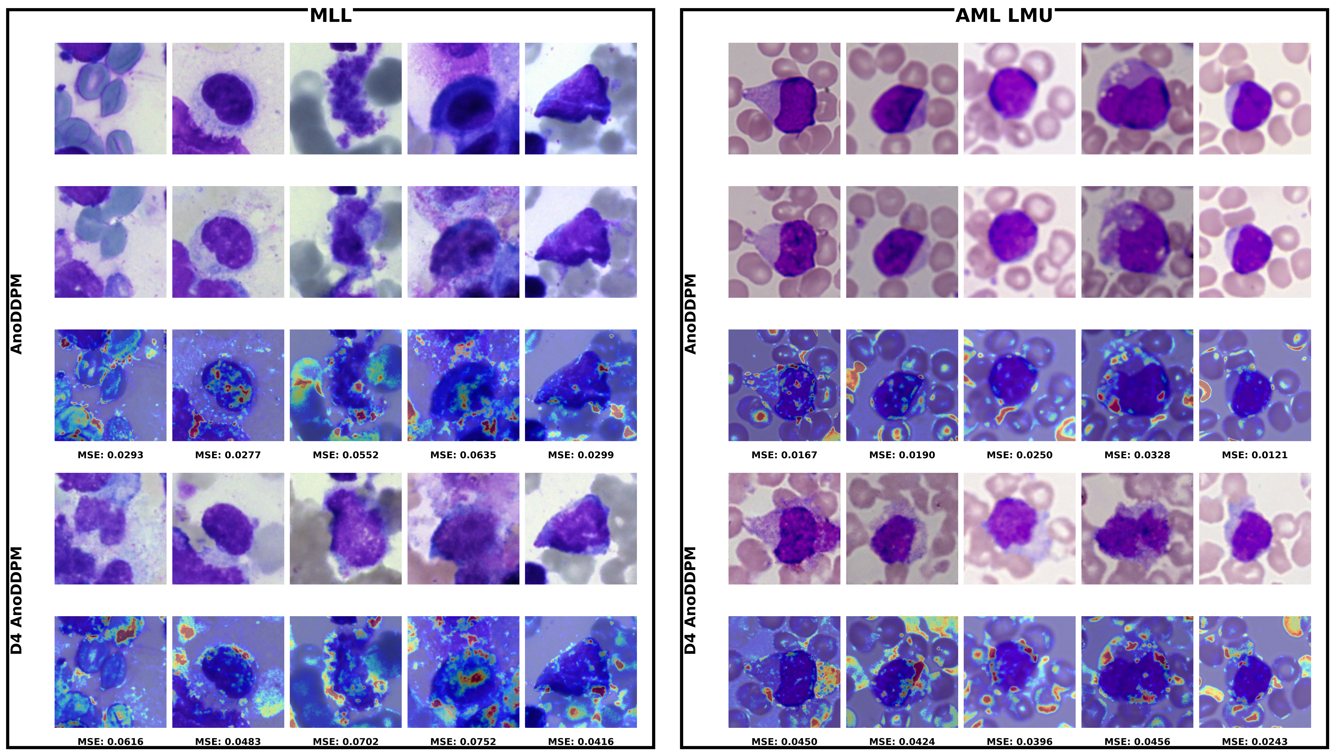 Qualitative comparison between AnoDDPM and D4-equivariant AnoDDPM